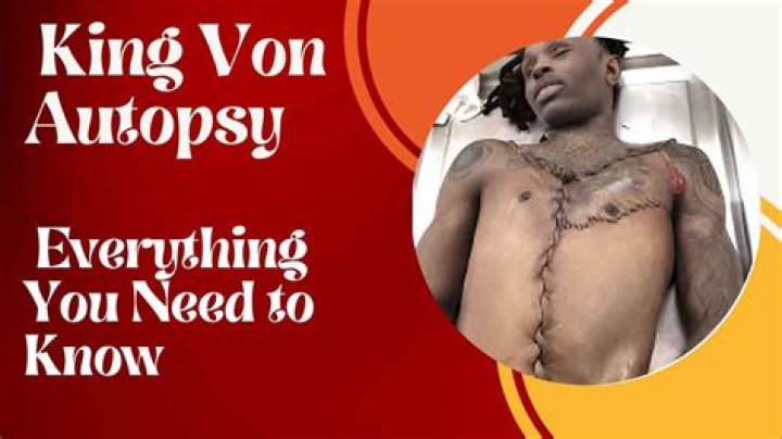 King Von Autopsy: An In-Depth Analysis and Legacy